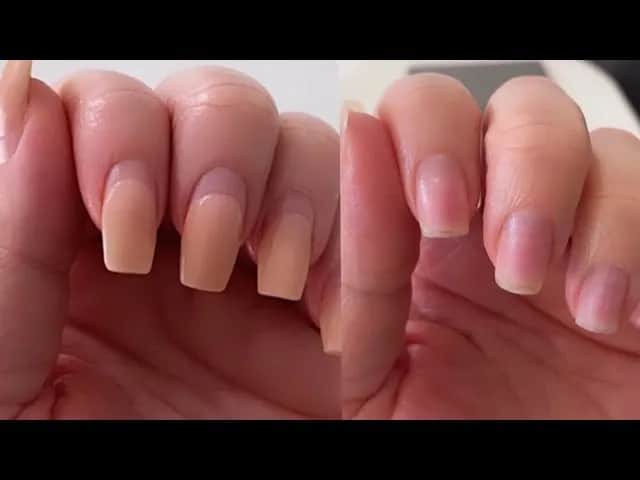 Gelnägel entfernen: Sicher & schonend zu Hause meine Expertentipps